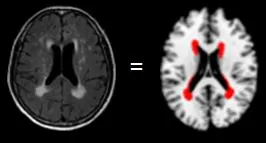 brain-1